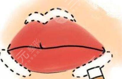 m唇前后對(duì)比果明X嗎？來(lái)看m唇整形真實(shí)案例，嘟嘟唇好可愛(ài)！