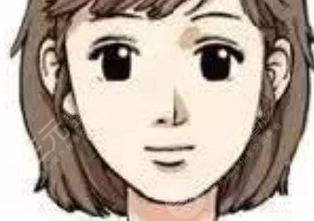 上海華美下頜角真人案例