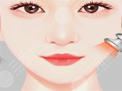 去頰脂墊瘦臉明X嗎？來看真人去頰脂墊瘦臉的手術(shù)過程及恢復果