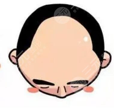 深圳三甲植發(fā)醫(yī)院