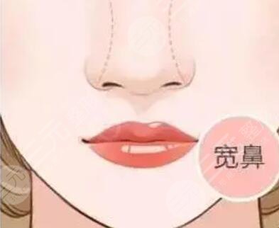 牡丹江紅旗醫(yī)院整形外科醫(yī)生介紹