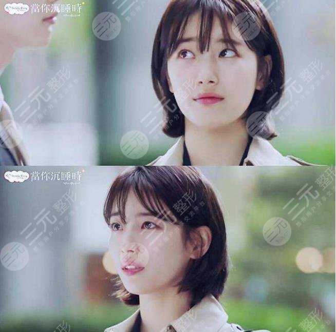 裴秀智微整泡到李敏鎬！從土氣女孩到韓劇女主？她動(dòng)了哪些地方？