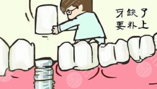 牙齒種植