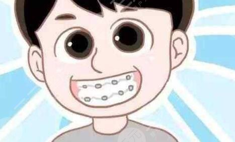 廣大口腔醫(yī)院種植牙