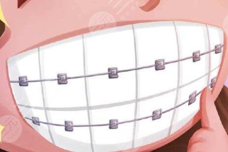 廣大口腔醫(yī)院種植牙