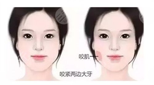 柳春明正頜真人案例