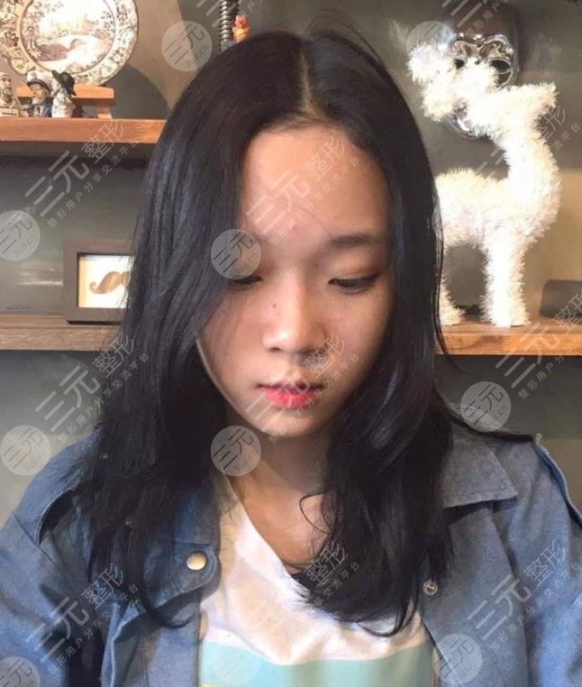 金玟庭winter陷整容風波，她動了哪里?