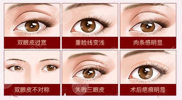 國(guó)內(nèi)眼修復(fù)項(xiàng)目科普