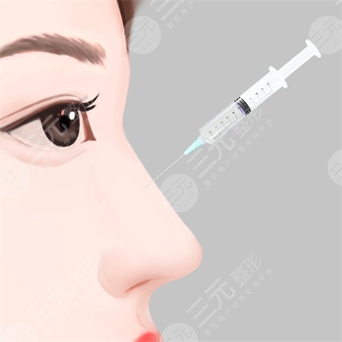 廣州隆鼻案例分享