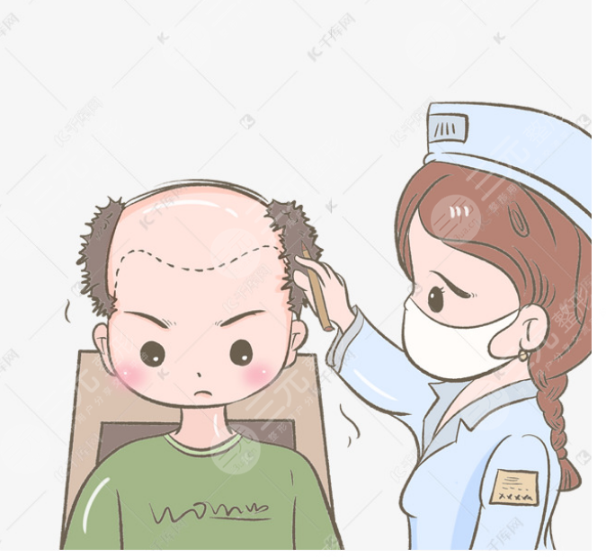 上海九院植發(fā)劉清醫(yī)生案例分享