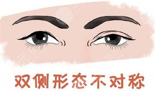 黃勝華醫(yī)生眼部手術(shù)術(shù)后果