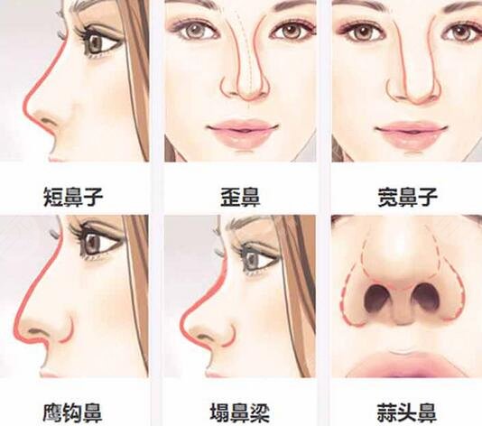 八大處范飛做鼻子風(fēng)格自然嗎？醫(yī)生個(gè)人簡(jiǎn)介|做鼻子案例