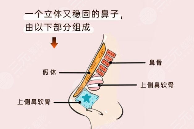 硅膠假體隆鼻創(chuàng)傷大嗎?