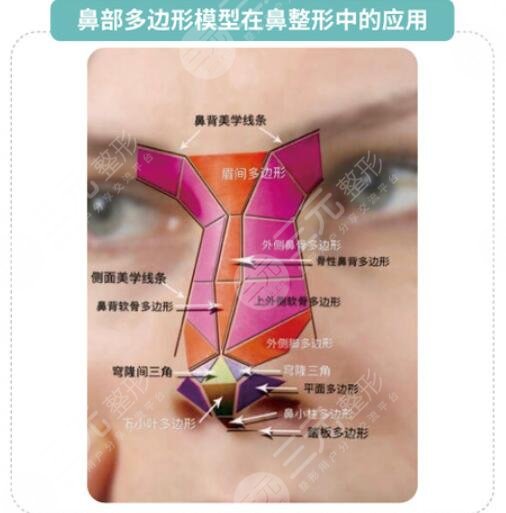 假體隆鼻