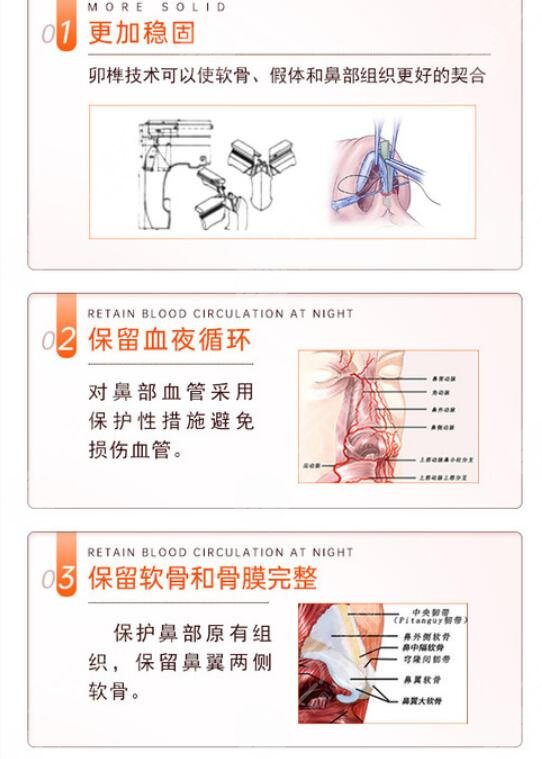 硅膠假體隆鼻是怎么操作的?