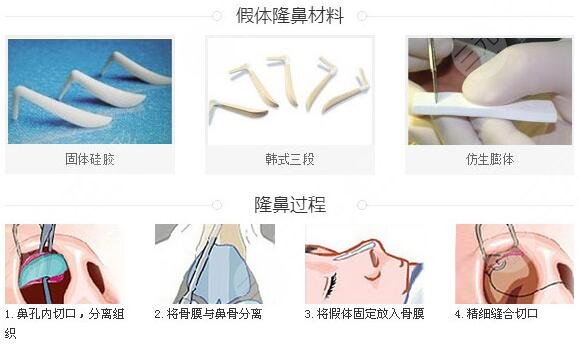 李長賦做鼻子案例術(shù)后7天