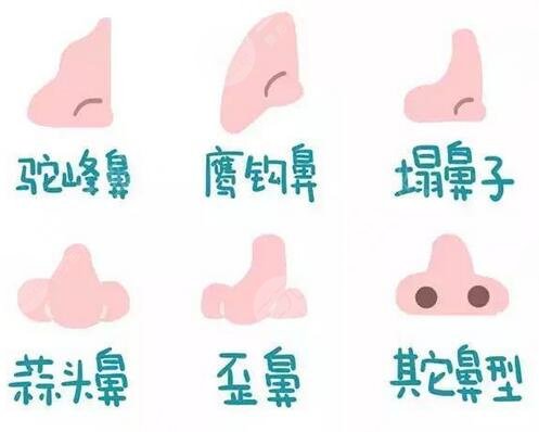 李長賦做鼻子案例術(shù)后36天
