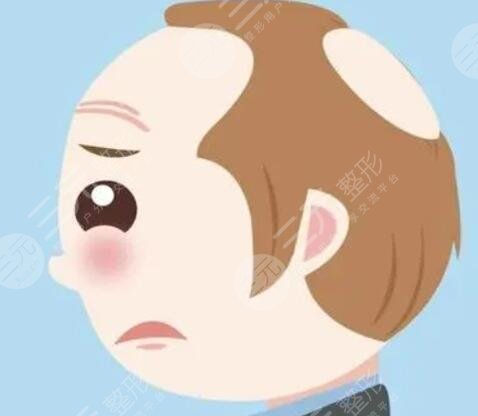 深圳大麥微針植發(fā)案例