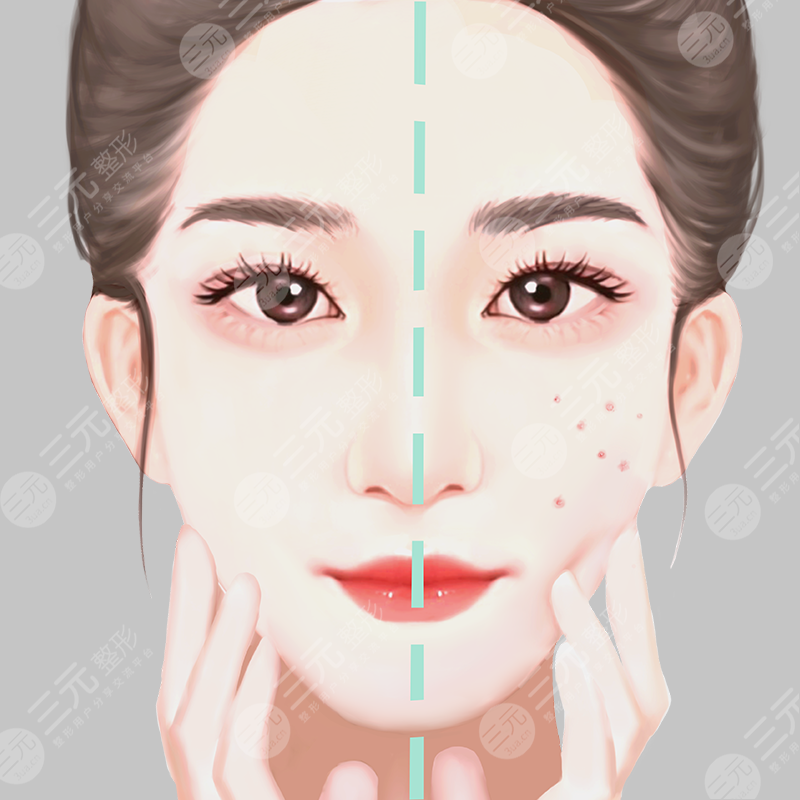 和平醫(yī)院整形外科開眼角多少錢？價格明細+真實開眼角案例~