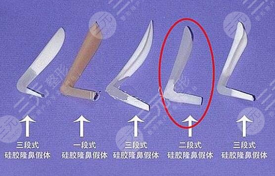 謝衛(wèi)國隆鼻術(shù)后3個月