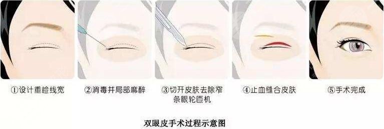 石家莊人民醫(yī)院美容科醫(yī)生技術(shù)好不好