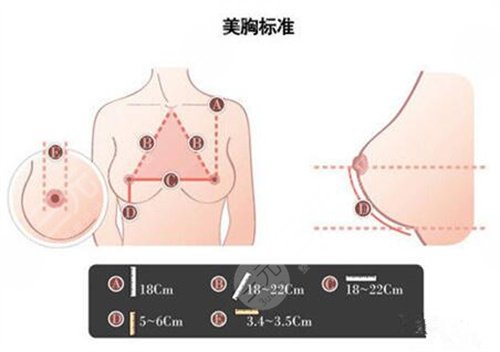 隆胸案例術前