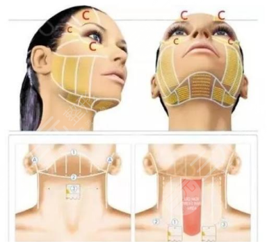 半島超聲炮好還是熱瑪吉好？原理_作用層次_適用人群等盤點(diǎn)！