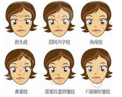 超聲炮和熱瑪吉的適用人群都有哪些?