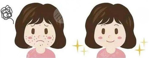點陣激光案例