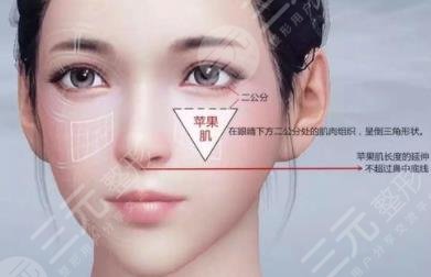 蘋果肌