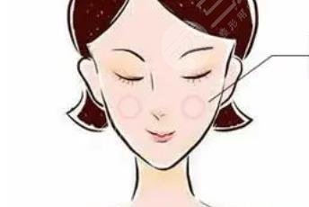 蘋(píng)果肌