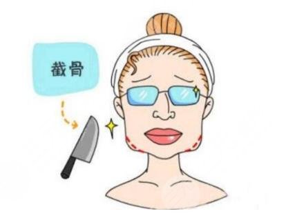 下頜角整容手術(shù)