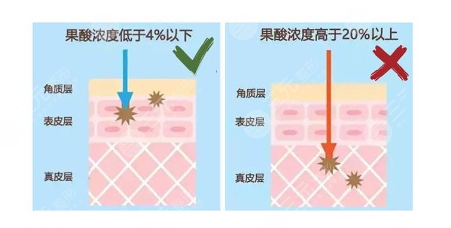 4問4答|讓你更懂！新手必備干貨~
