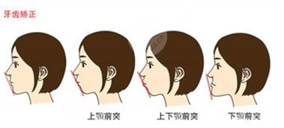 2020江蘇省口腔醫(yī)院價(jià)格表