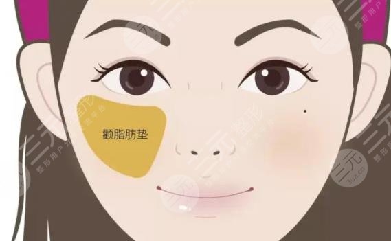蘋果肌