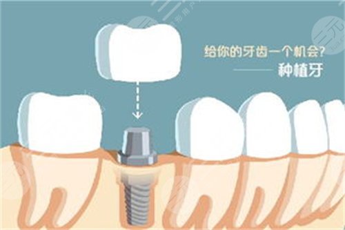 深圳友睦口腔收費標準