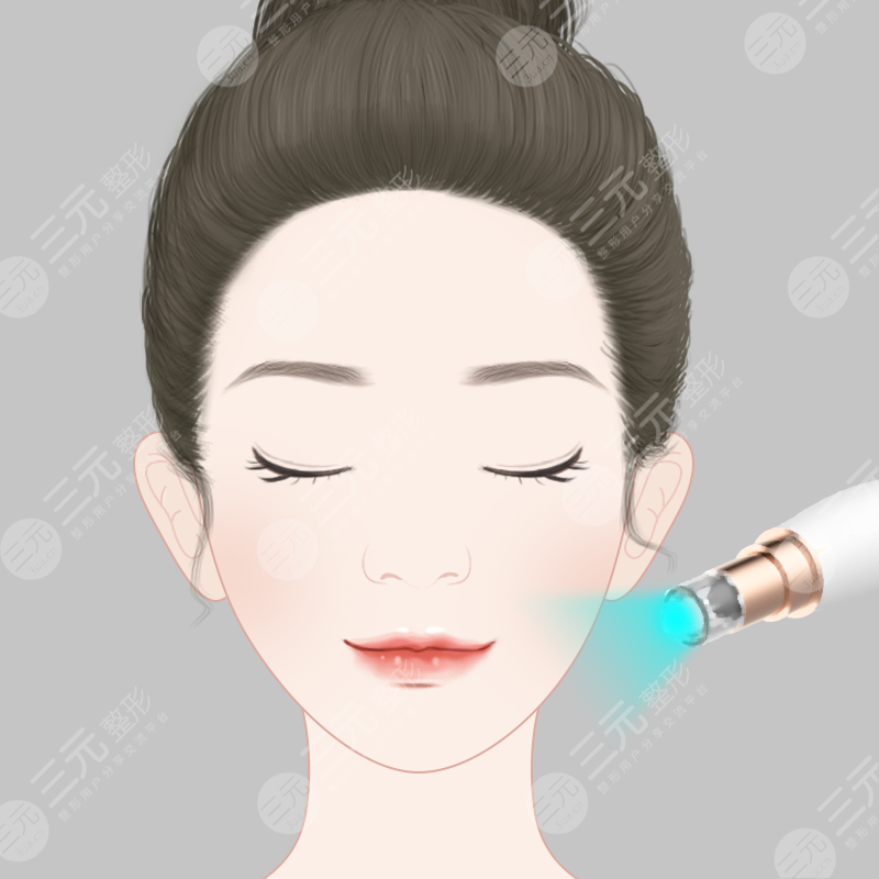 洗臉儀洗成敏感肌