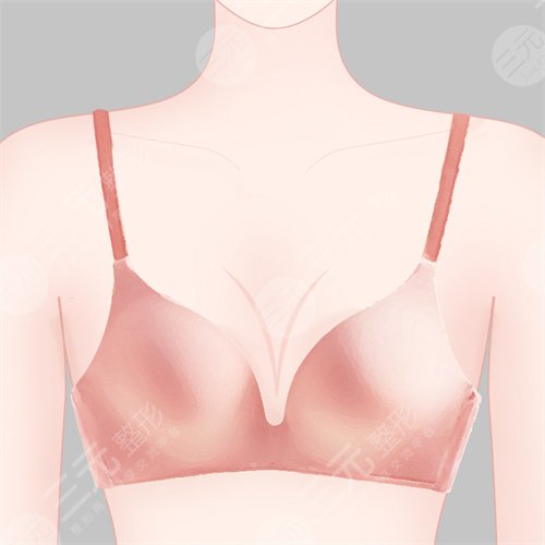 術(shù)后注意保護(hù)假體