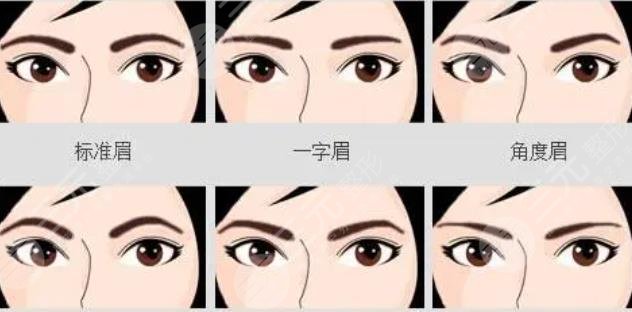 種植眉毛