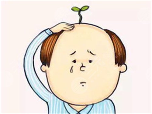 上海九院植發(fā)手術(shù)經(jīng)歷