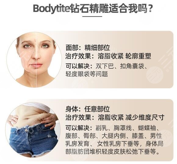 雙下巴吸脂