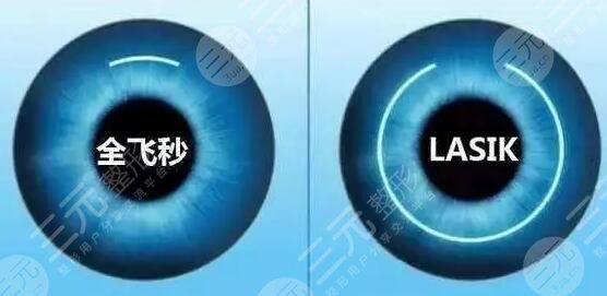 近視眼激光手術(shù)之后會(huì)瞎嗎?