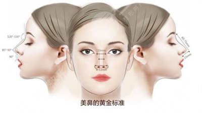 鼻翼修復(fù)手術(shù)