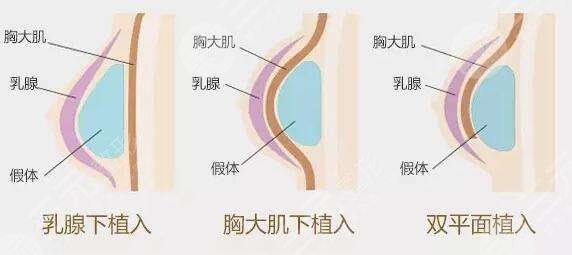 娜綺麗和傲諾拉哪款好？