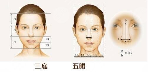 隆鼻手術一個月