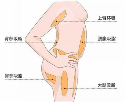 小S