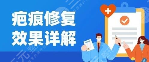 王連召醫(yī)生祛疤項目科普