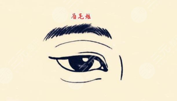 種植眉毛