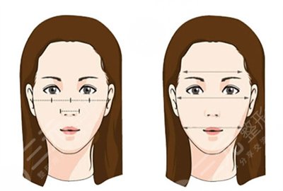 北京愛美整形醫(yī)療一針瘦臉案例