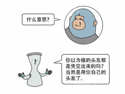 吳巍醫(yī)生植發(fā)案例